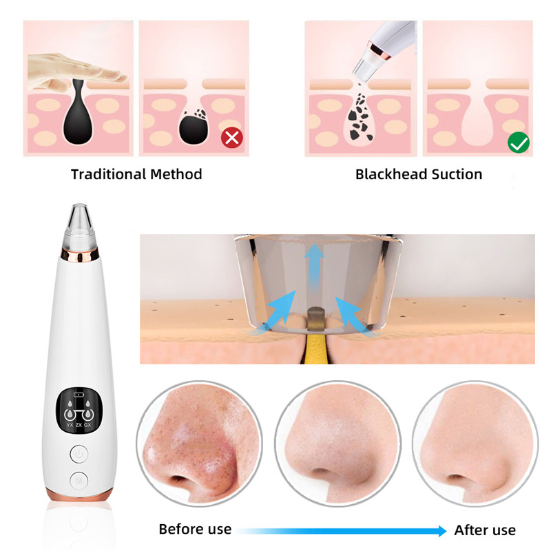Electric Pore Cleaner Blackhead Remover Vacuum Face Skin Care Suction Black Dots Blackheads Pimples Removal Deep Cleaning Tool