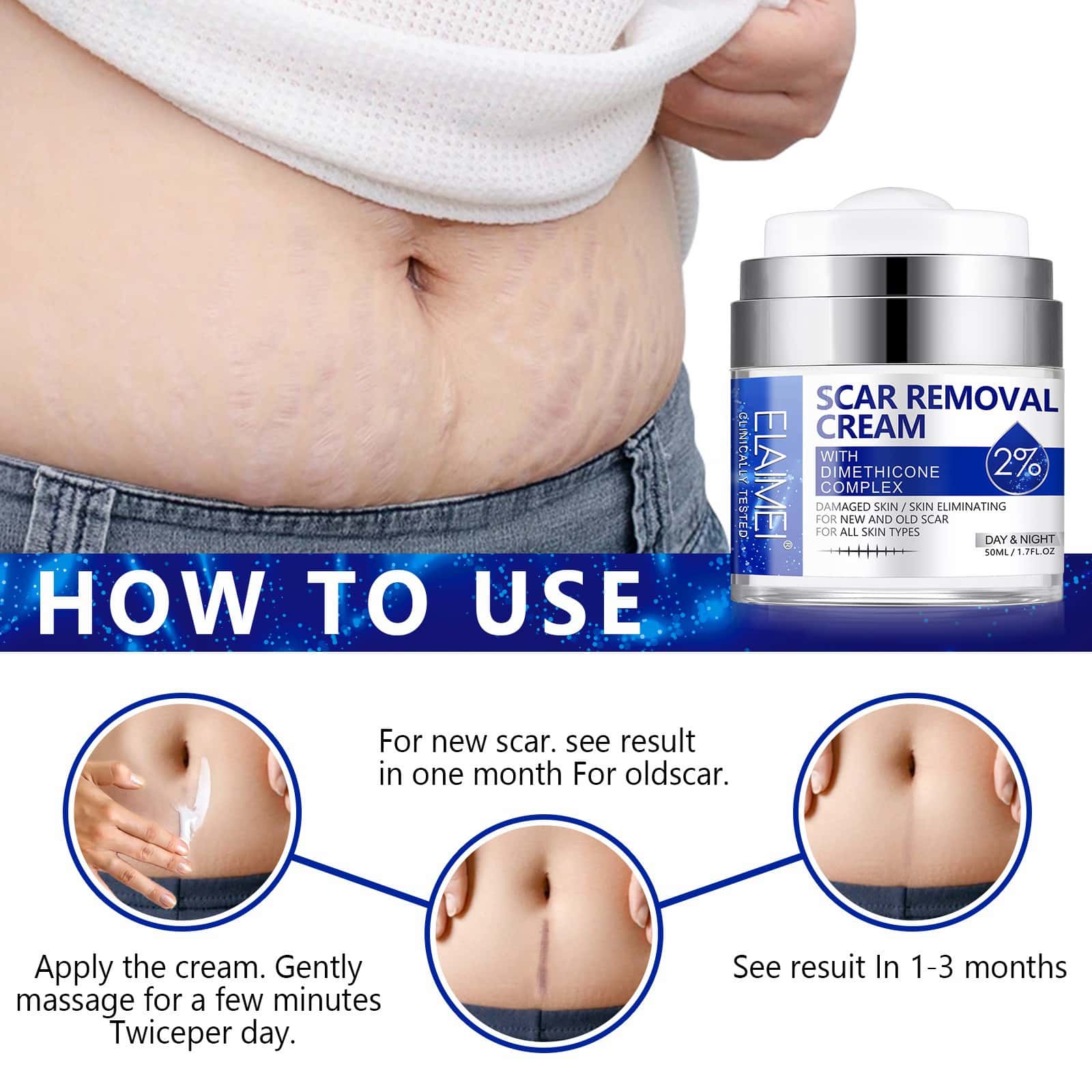 ELAIMEI's new pressed scar cream scar desalination cream 50ML.