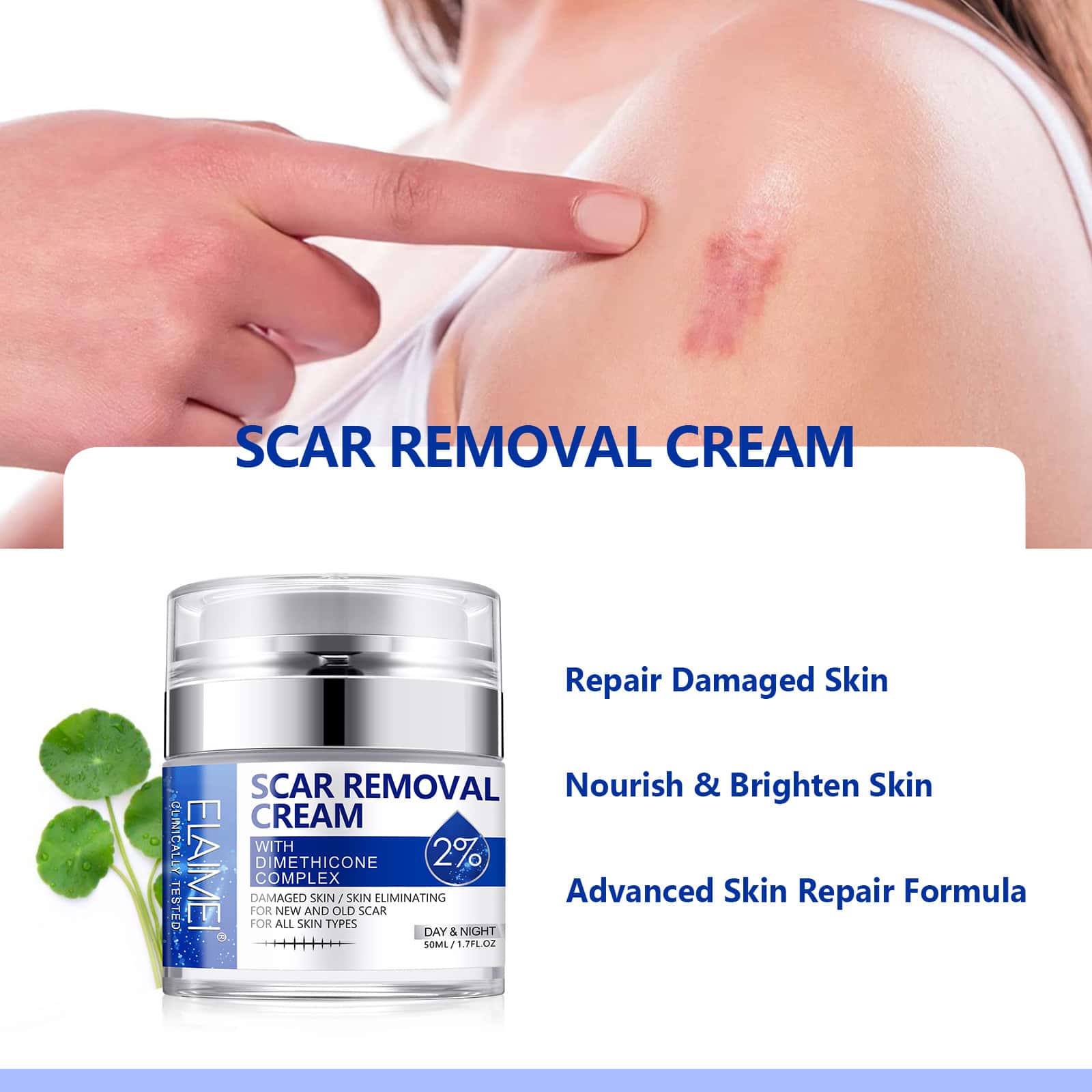 ELAIMEI's new pressed scar cream scar desalination cream 50ML.