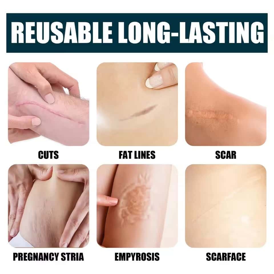 ELAIMEI's new pressed scar cream scar desalination cream 50ML.