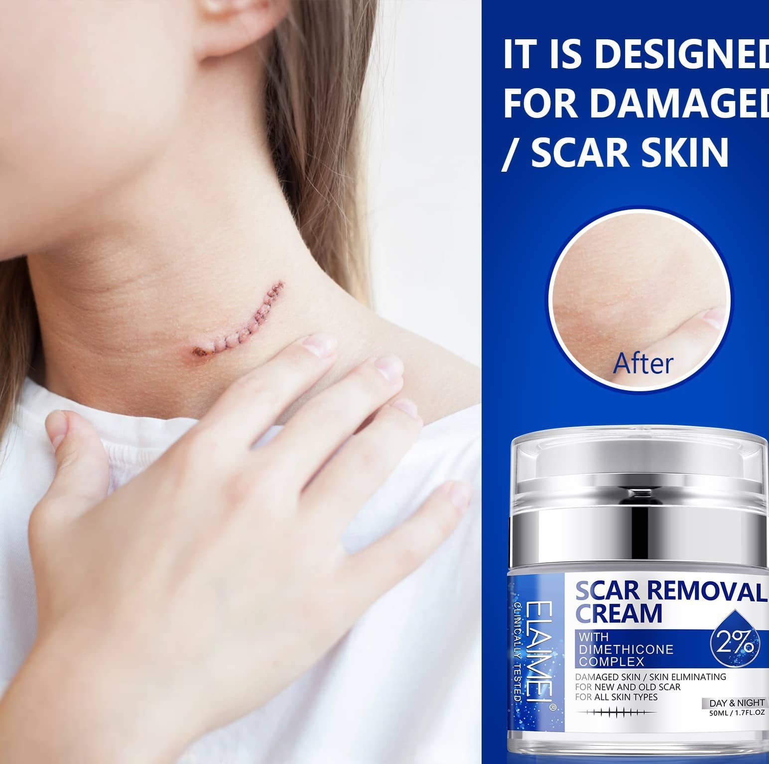 ELAIMEI's new pressed scar cream scar desalination cream 50ML.